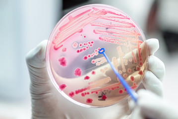 Close up the media plate on hand medical technicians working on bacterial culture and drug...