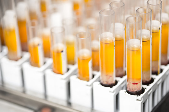 Laboratory Glass Test Tubes Filled With Orange Liquid For An Experiment In A Science Research Lab