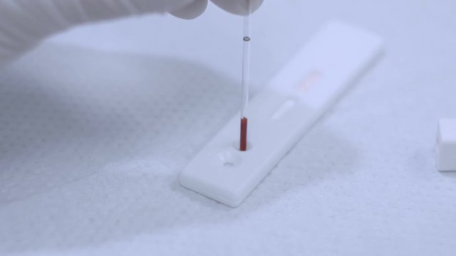 Blood sample drop to analyzer. Closeup of blood test process. Close up of medical test blood. Hiv blood analyzer. Hiv testing equipment. Medical testing. Lancelet and medical analyzer