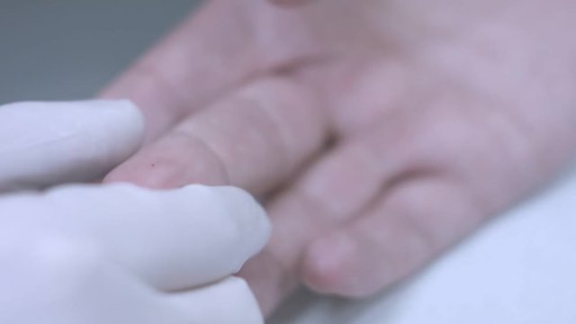 Finger blood analysis. Close up of take blood finger. Medical hand taking blood from finger. Finger needle puncture. Test blood sample. Taking medical analysis
