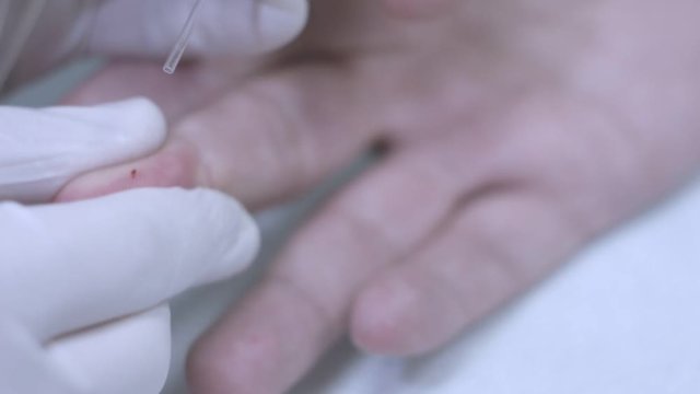 Taking blood sample from finger. Close up of hands in glove draw blood finger. Collection blood analysis. Take blood sampling. Hiv testing process