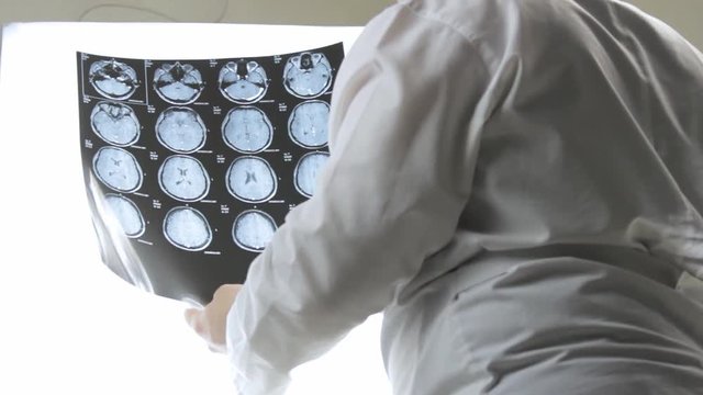 The doctor holds in his hands an MRI scan of the brain, diagnosis