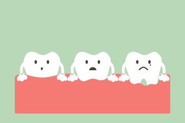 step of gum disease