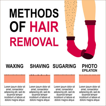 Depilation Vector illustration Poster template Women's legs in red socks with hair and after hair removal Types of depilation with description