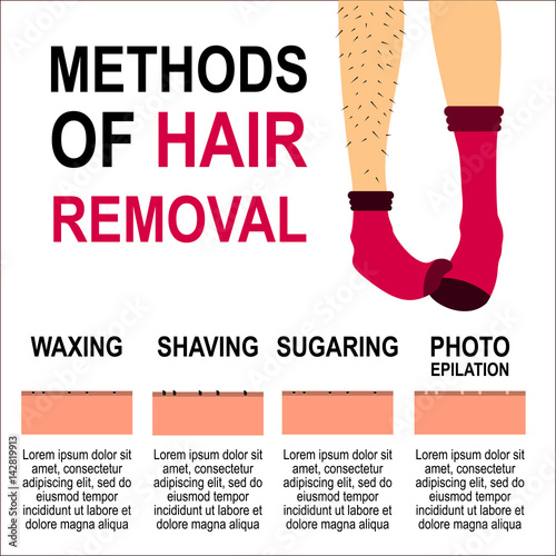 Depilation Vector Illustration Different Types And Methods Of