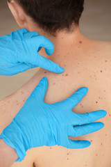 Dermatologist examining patient in clinic