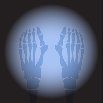 X ray feet. Human skeleton's part on black background.