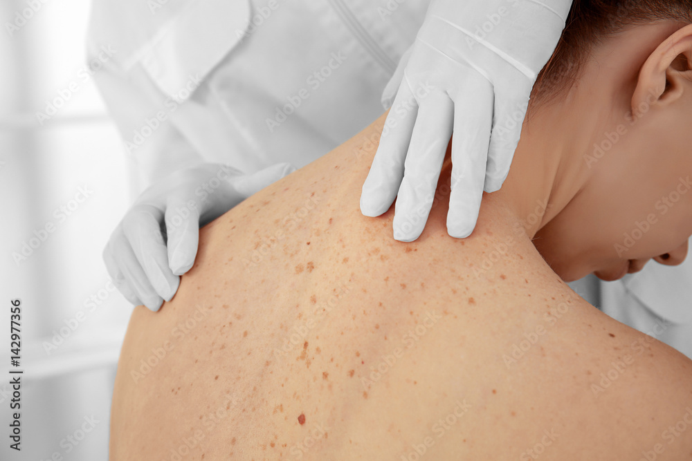 Wall mural dermatologist examining patient in clinic, closeup