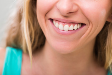 Photo of woman with beautiful white teeth.