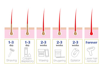 Comparison of the popular methods of hair removal: laser, epilator, waxing, shaving, shugaring,