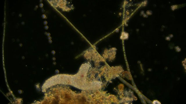Amöbe / Wechseltierchen unter dem Dunkelfeld Mikroskop in 4K