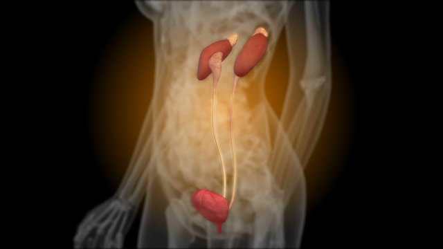 X-ray of the kidneys