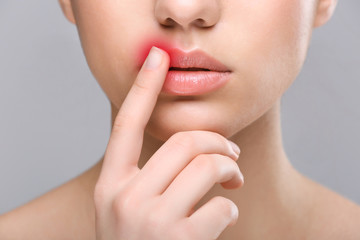 Fototapeta na wymiar Woman with cold sore touching lips on light background