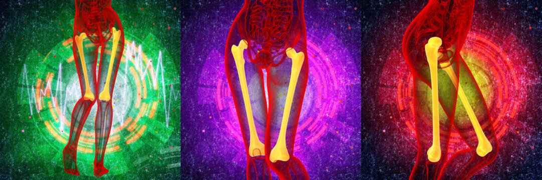 3d rendering medical illustration of the femur bone