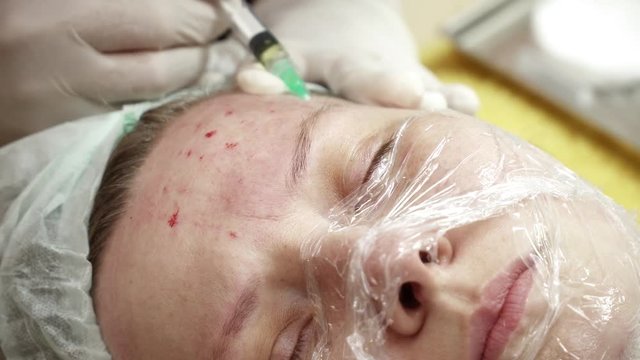 Beautician making injections for the woman in beauty salon closeup