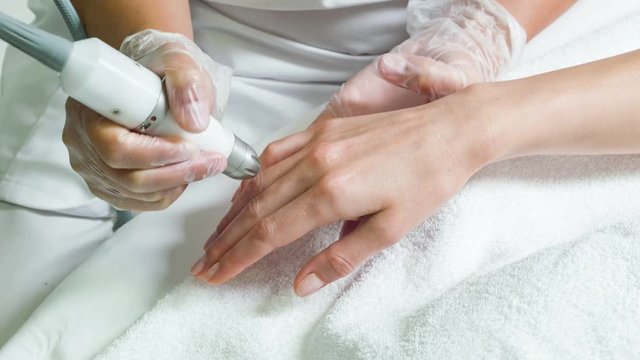 Skillful beautician undergoing microdermabrasion therapy on female arm