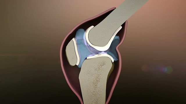 human bone destruction, human joint destruction, 3d rendered knee illustration, pain illustration knee side, 3d illustration knee side, human knee destruction