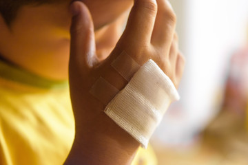 Wound on hand of child.Close up and concept for health