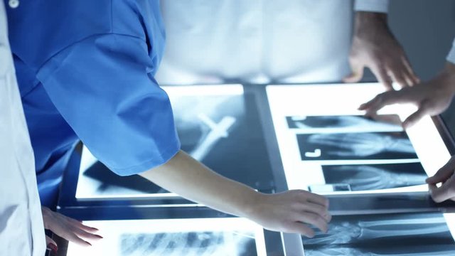  Medical team in a meeting, looking at patient x-rays on a light box