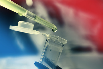Pipette drop of stem cells research fluid in a vial held by forceps