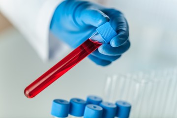 Hands of a lab technician with a tube.