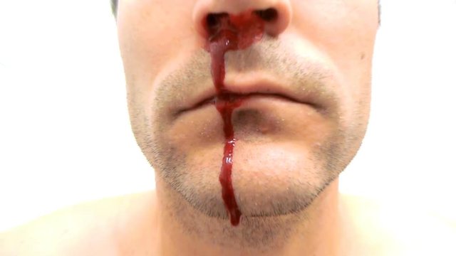 Man's nose bleeding with zoom in effect.