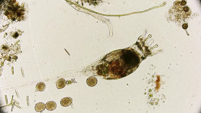 R&auml;dertier Collotheca unter dem Mikroskop in 4K