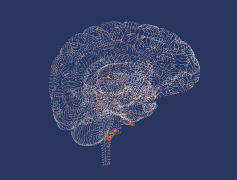 Cervello, malattie degenerative, Parkinson, Alzheimer