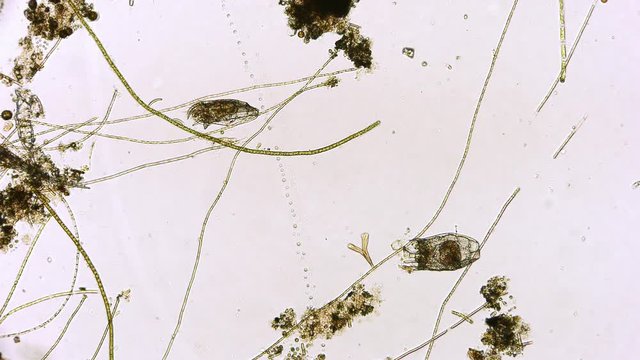 R&auml;dertierchen Rotifer unter dem Mikroskop in 4K