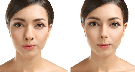 Young woman before and after rhinoplasty on white background. Plastic surgery concept