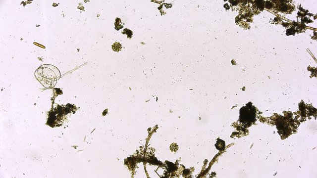 Zieralgen und Kieselalgen unter dem Mikroskop in 4K