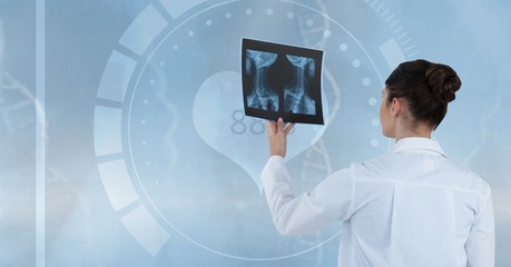 Doctor (women) looking a x-ray photography