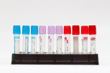 Test tubes for lab, isolated. Close-up of test tubes arranged on a tray in medical laboratory.