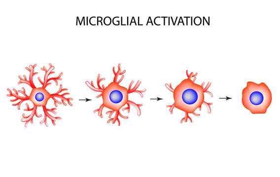 Activation of microglia. Neuron. Nerve cell. Infographics. Vector illustration on isolated background.
