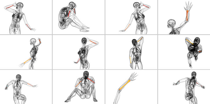 3d rendering medical illustration of the radius bone