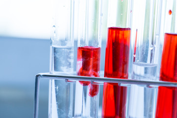 Background of Blood test and experimental in laboratory