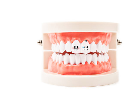 Dental Model, tooth get sick on white background