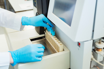 Hands of laboratory assistant loading sample tubes for coagulation test analysis