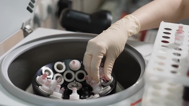 A centrifuge spins vials of liquid in a laboratory test. A medical assistant or doctor, is involved in the loading of blood samples into a centrifuge. The device will divide the blood into fractions.