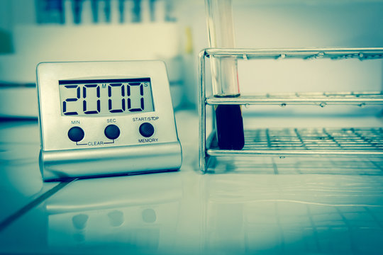 Clotted blood in test tube vct teasting in laboratory.