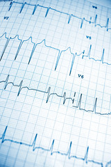 Electrocardiogram