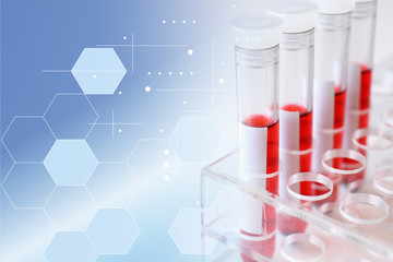 医療イメージ　血液検査