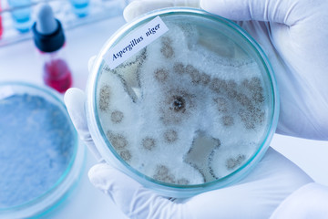 Background of Fungus (Aspergillus) in Petri dishes in laboratories for education in lab.