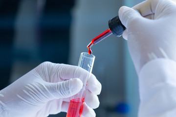 Background of Blood test and experimental in laboratory
