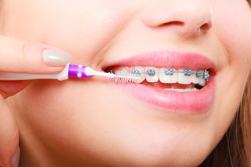 Woman brushing teeth with braces using brush