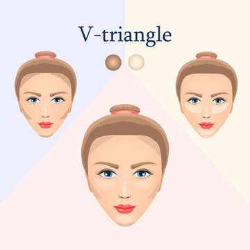 Correction for the V-triangular face