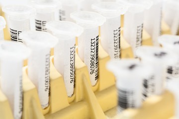 Test tubes arranged on medical trolley