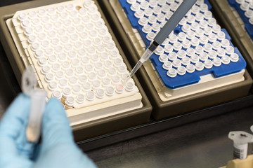 A chemical sample bottle. Centrifuge. A test tube vial sets for analysis.