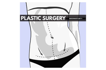 Body Plastic Surgery. Vector Illustration.