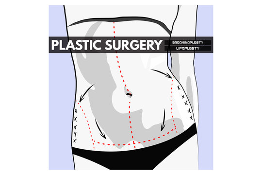 Body Plastic Surgery. Vector Illustration.